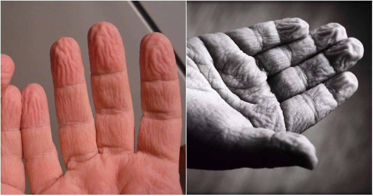 Why Do We Get Wrinkles On Wet Fingers Here Is The Reason
