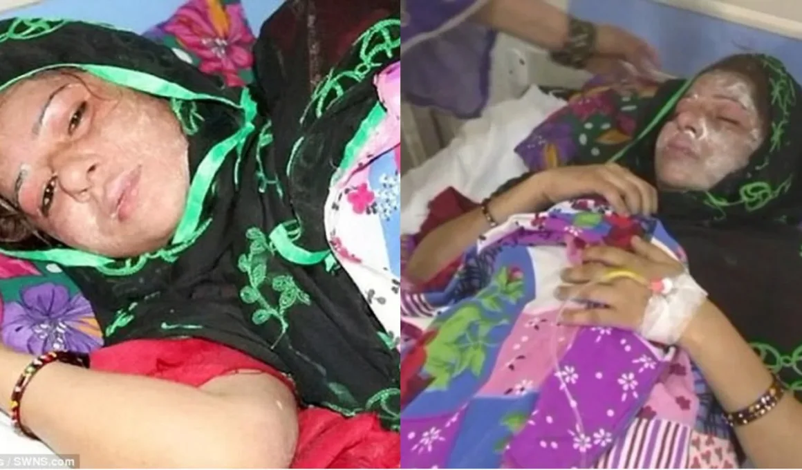 Indian Muslim Husband Throws Acid On Wife For Giving Birth To A Girl
