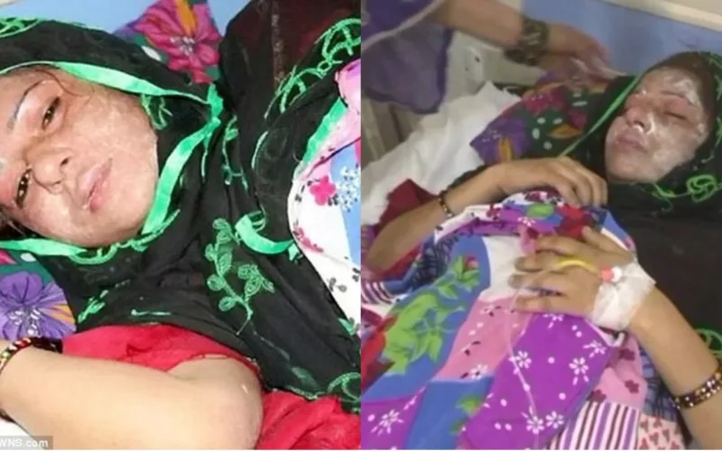 Indian Muslim Husband Throws Acid On Wife For Giving Birth To A Girl