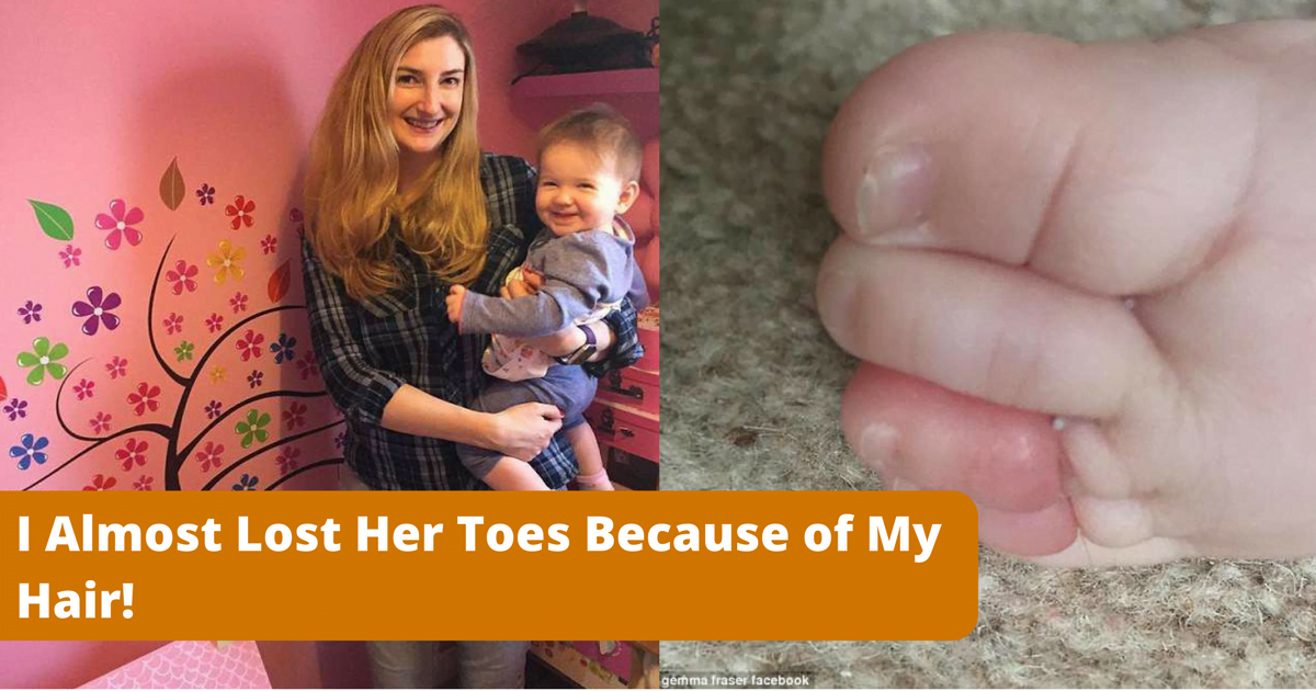 Mother Could Have Lost Her Daughter's Toes Because of Her Hair