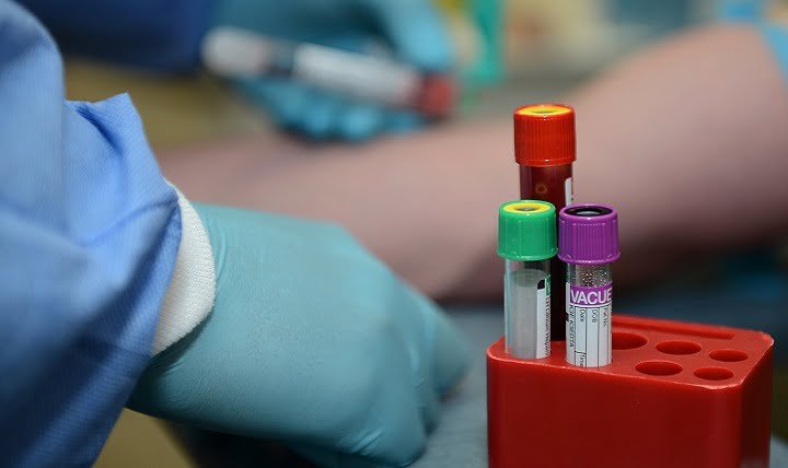 Does Blood Test Break My Fast