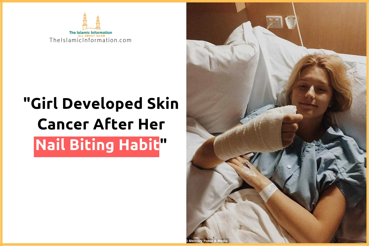 Girl Developed Skin Cancer After Her Nail Biting Habit