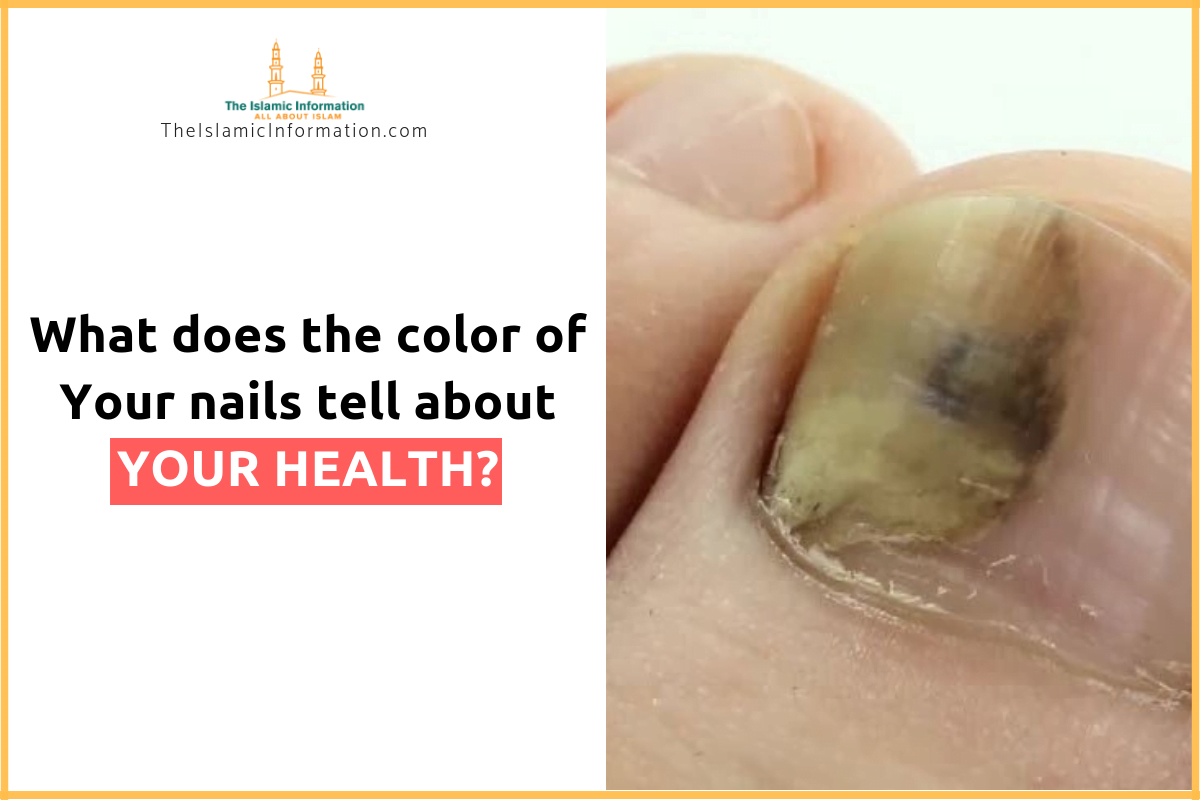 Color of Your Nails Tell About Your Health