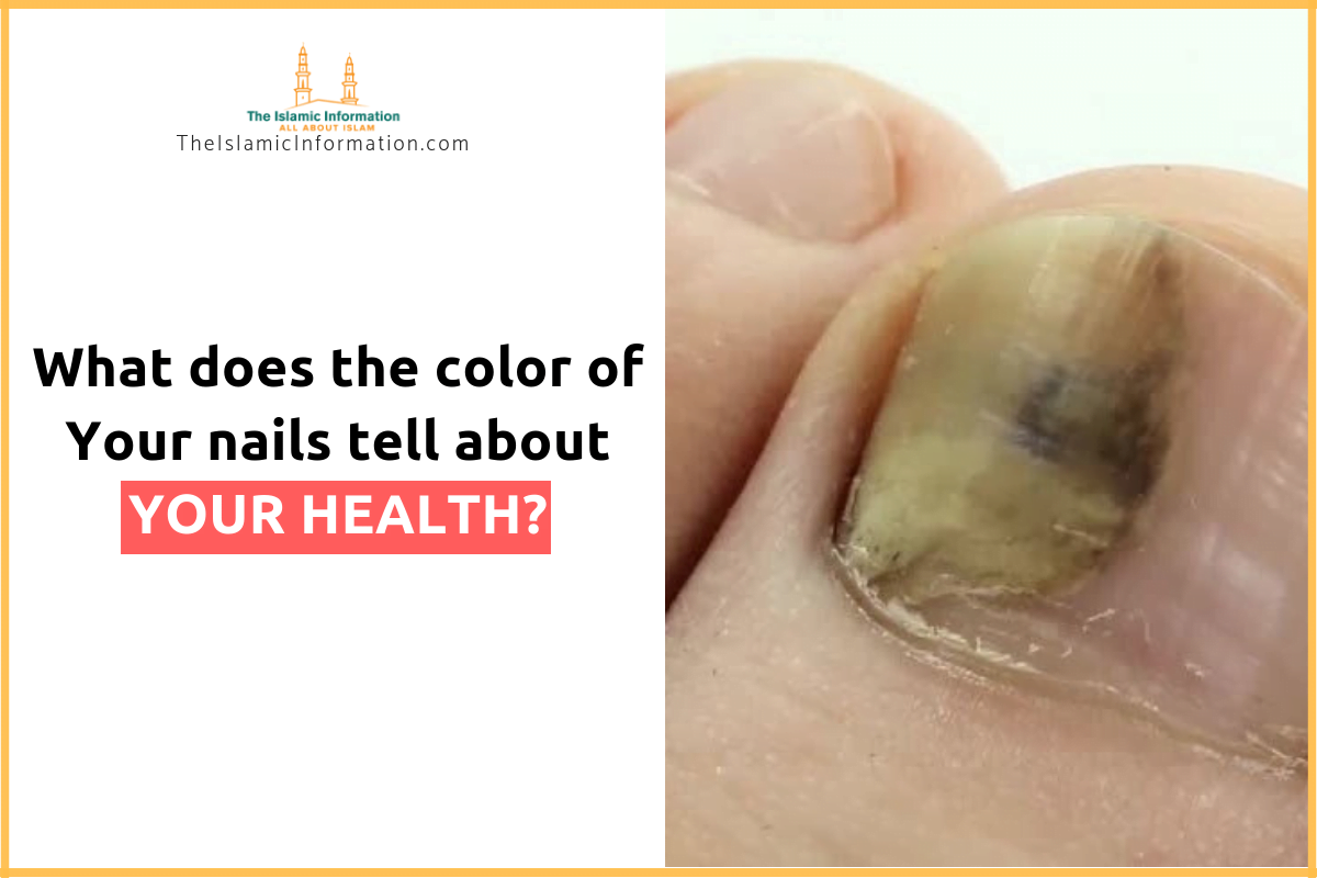 This Is What Does The Color of Your Nails Tell About Your Health