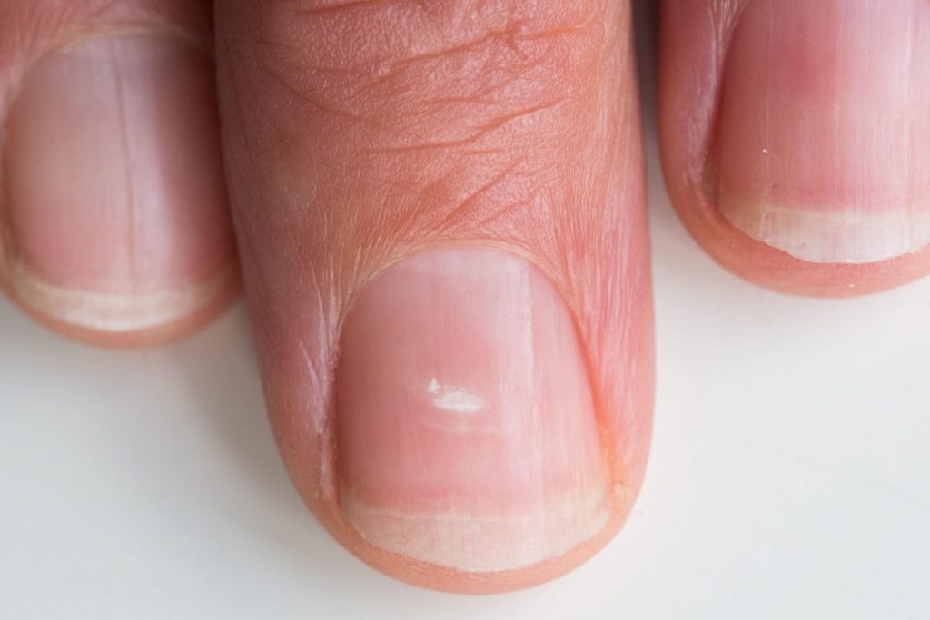 This Is What Does The Color of Your Nails Tell About Your Health