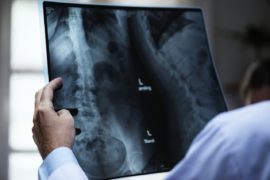 Best Dua For Bone Pain and Other Bones Problem for Relief