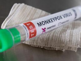 Monkeypox Officially Declared As World Health Emergency.