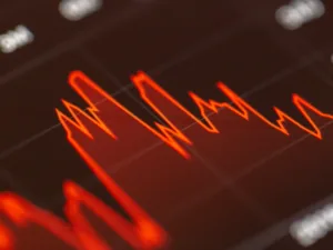 Stock Graph